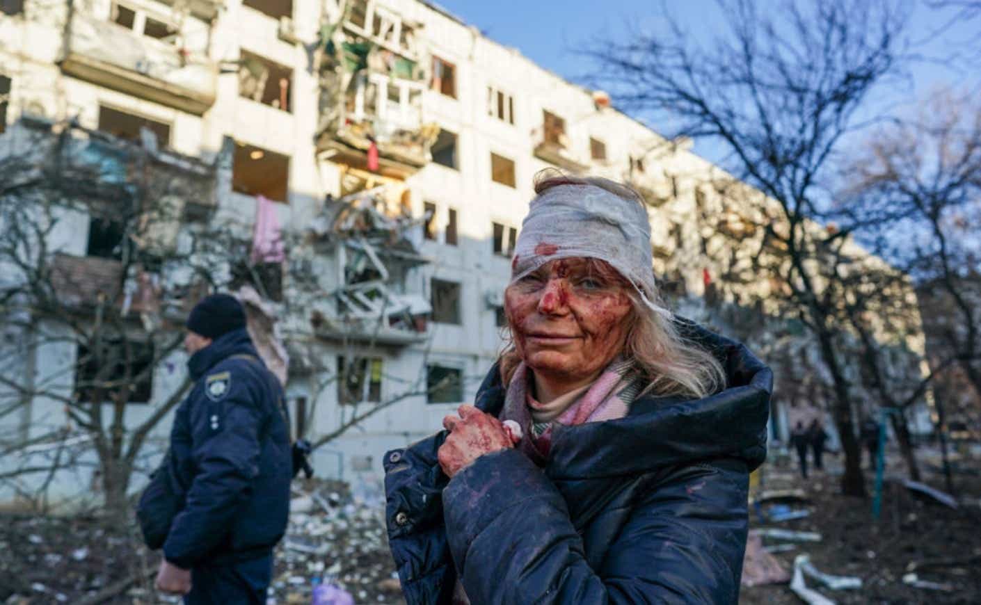 injured Ukrainian woman