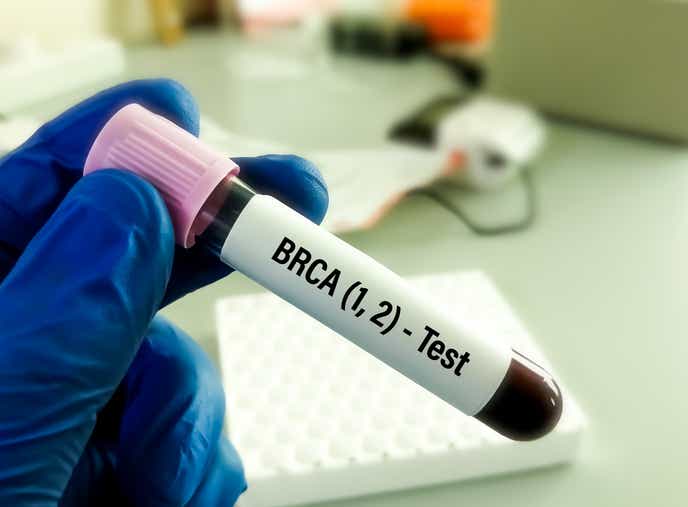 BRCA 1, 2 test tube held in gloved hand