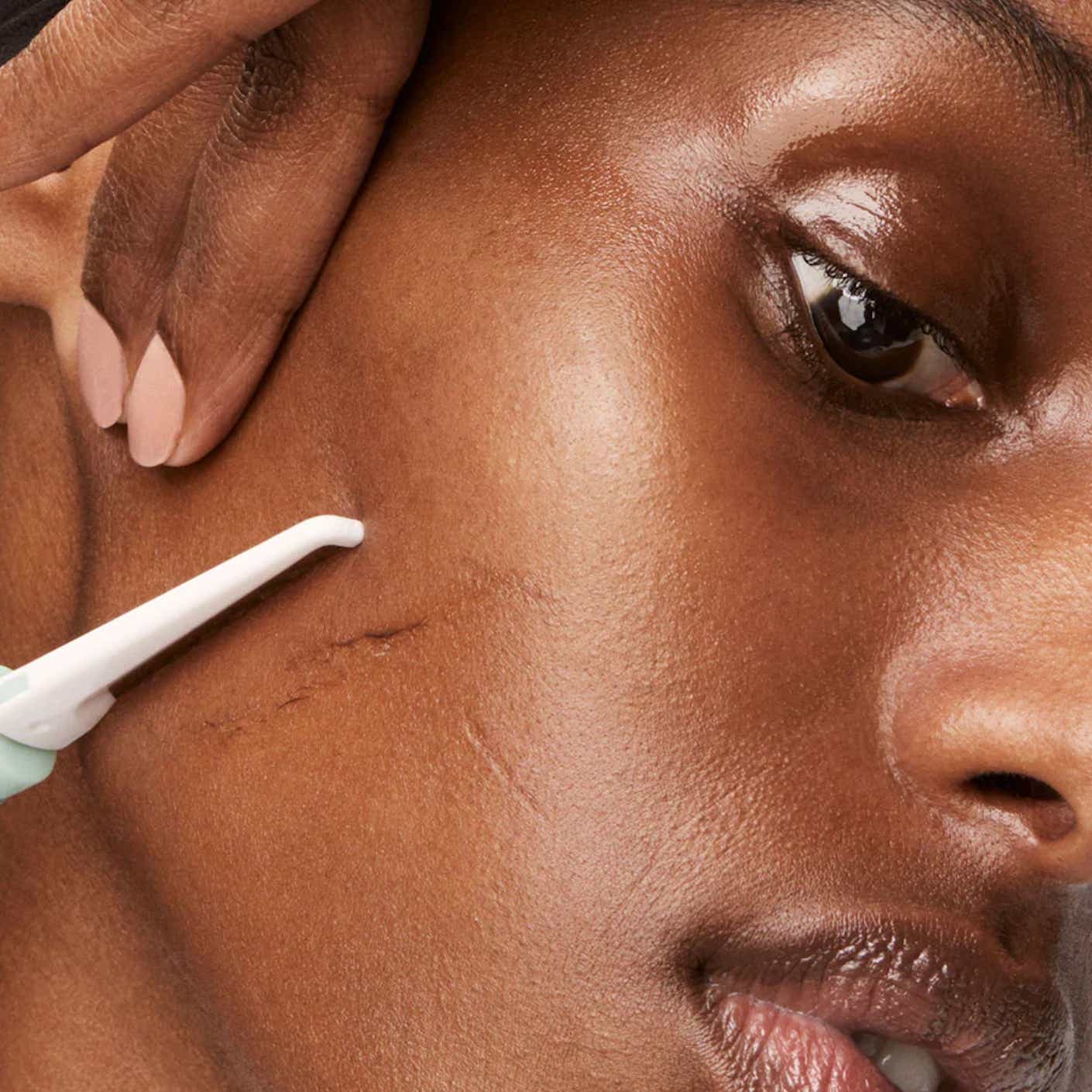 A close up of a woman's face as she uses the dermaplaning razor to shave peach fuzz off of her cheek.