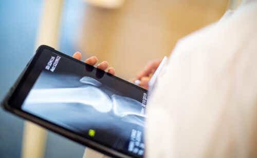 a doctor looking at an xray of a knee