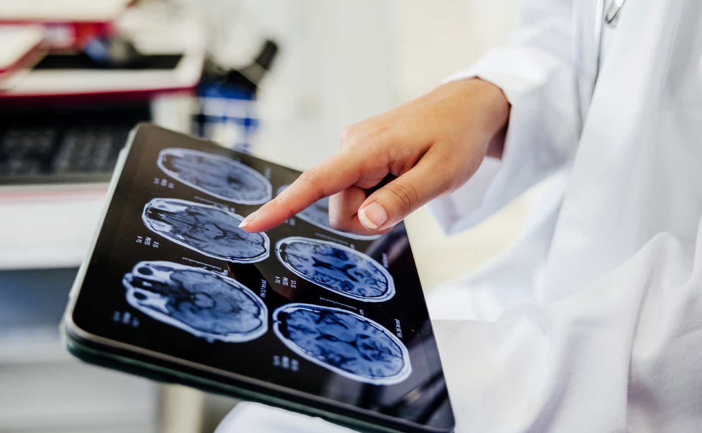 a doctor points to a scan of a brain