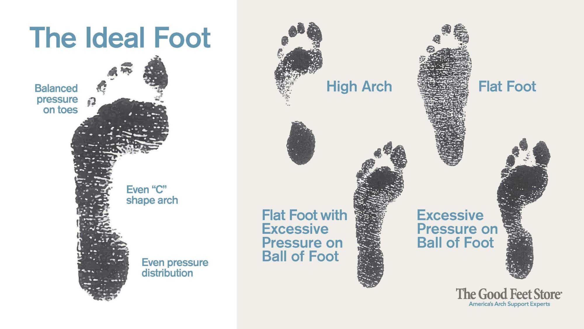 Illustration showing how footprints differ depending on arch height. 