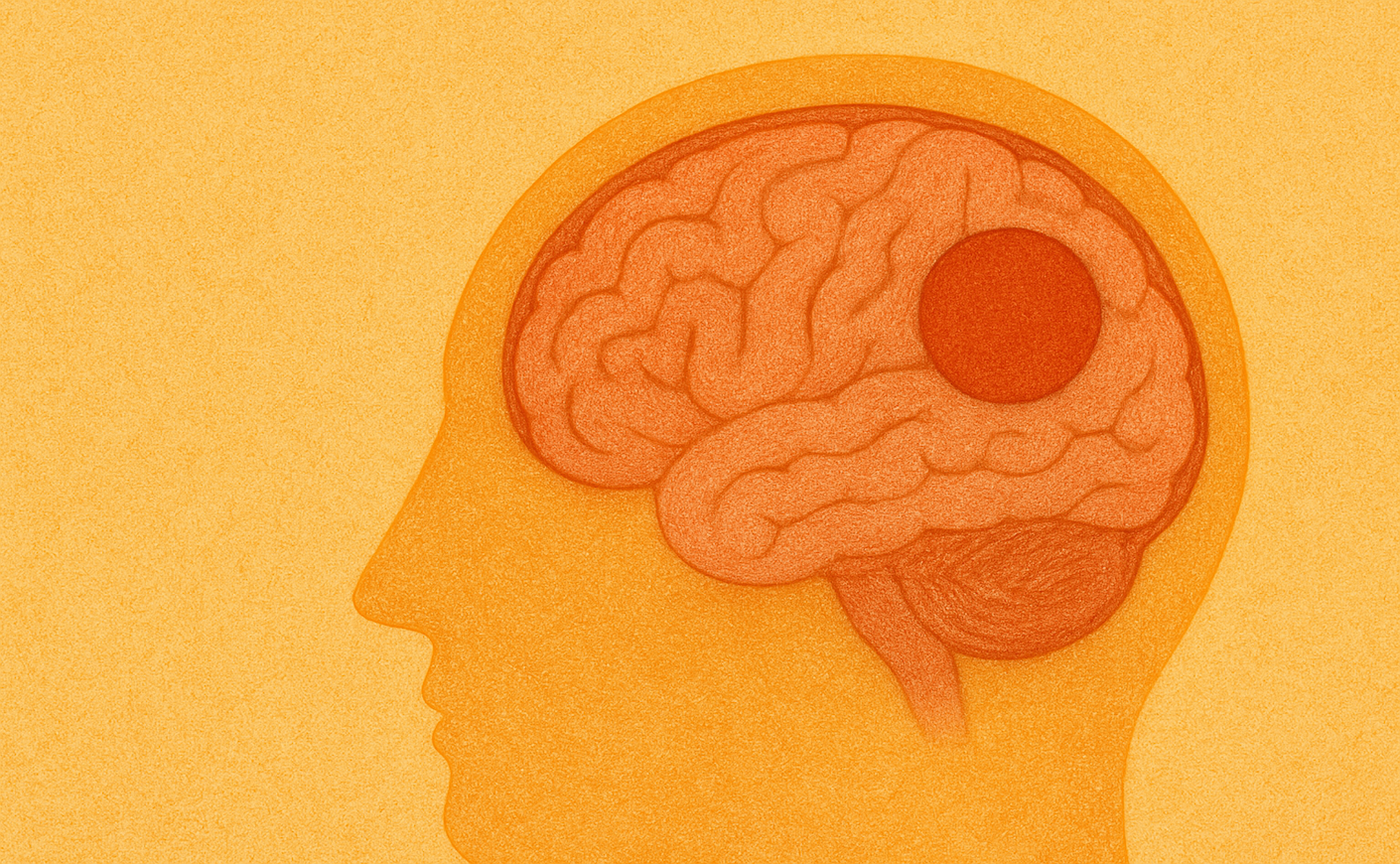 illustration of a blank face showing a brain with a tumor