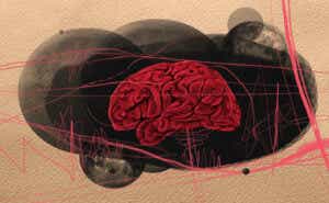 illustration of a brain with lines all over it