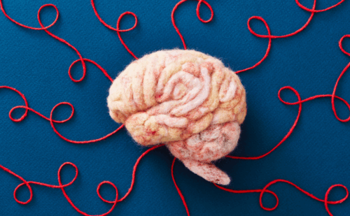 a brain with pieces of yarn leading to it
