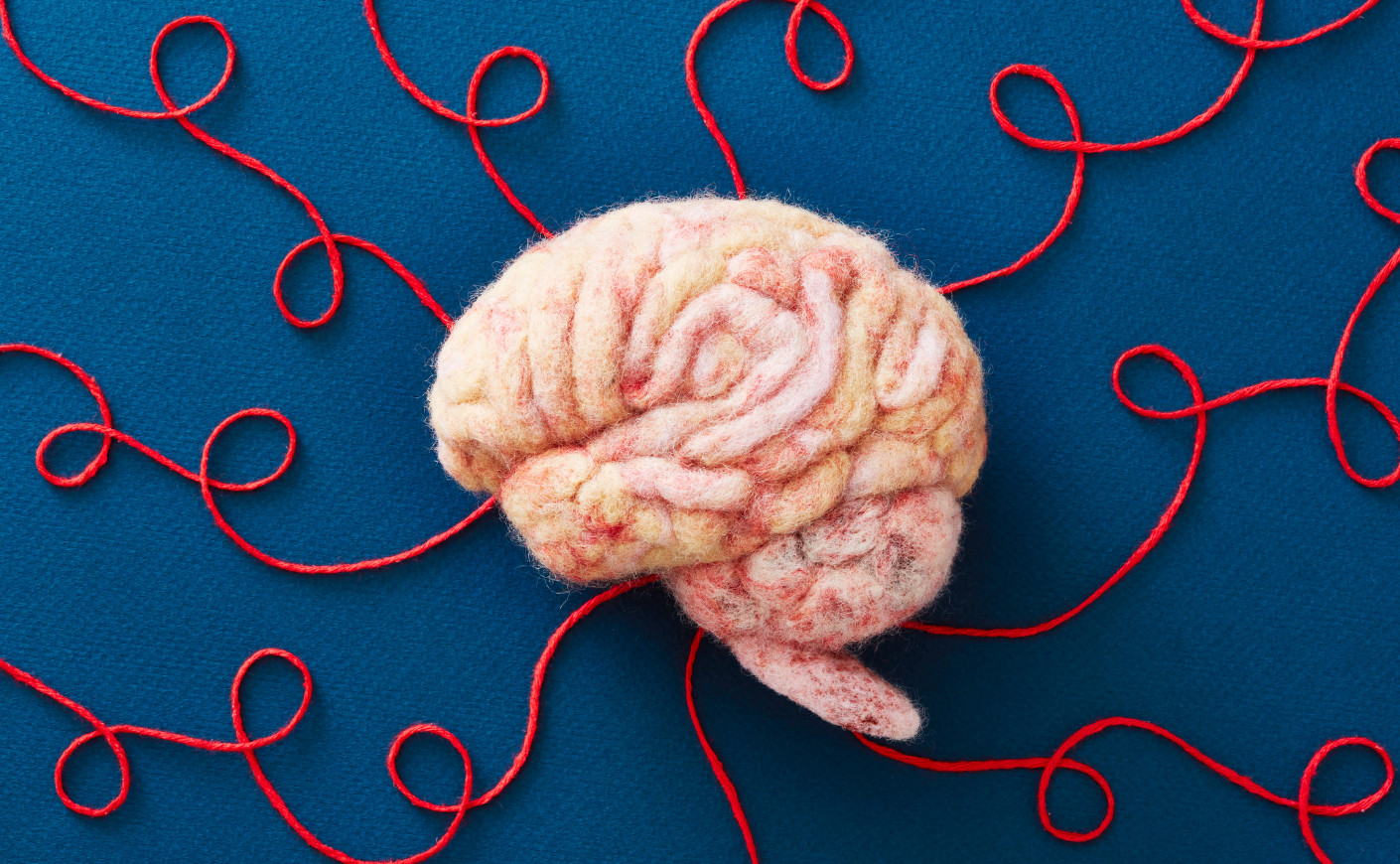 a brain with pieces of yarn leading to it