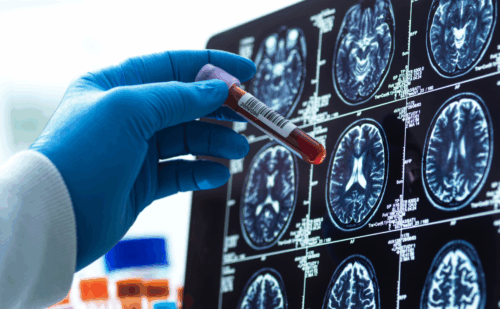 a vial of blood next to brain scans
