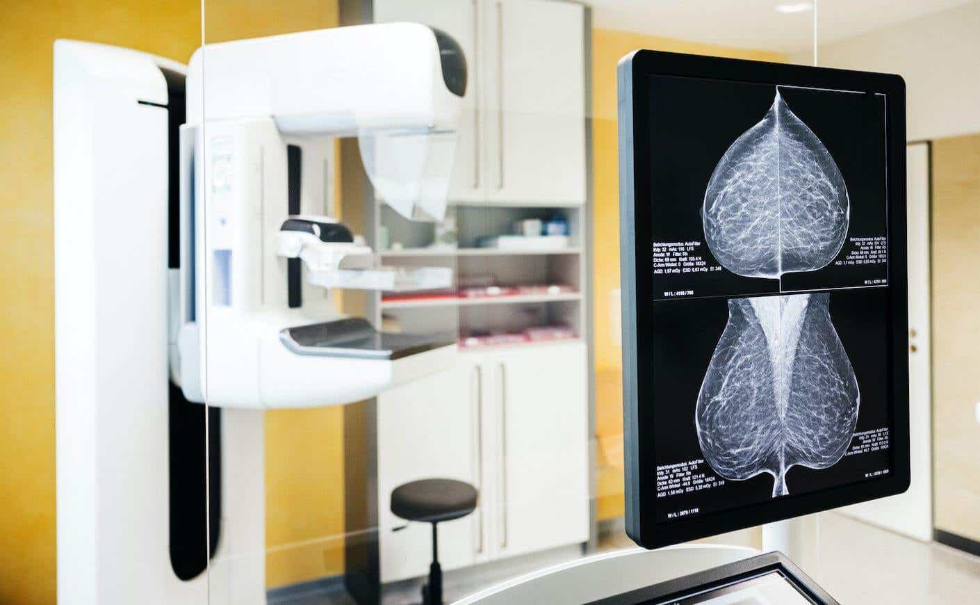 A mammogram machine shows results.