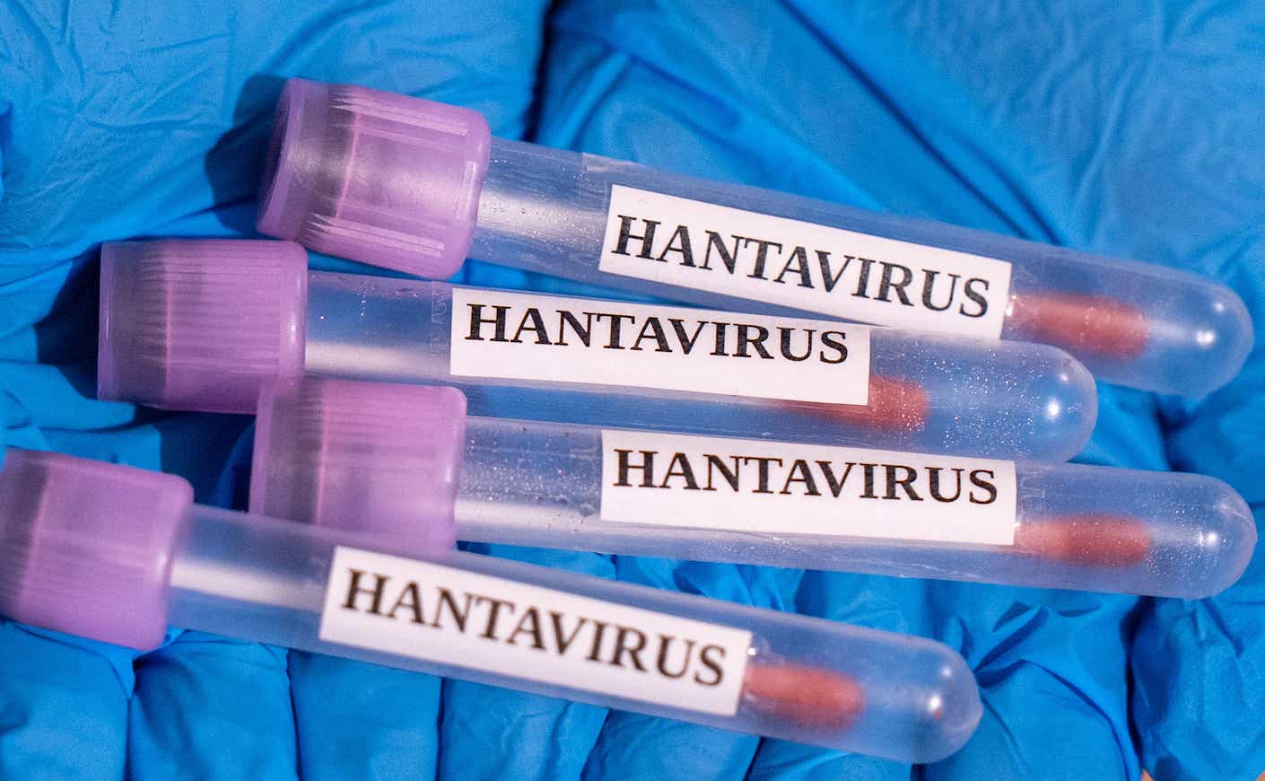 Hantavirus