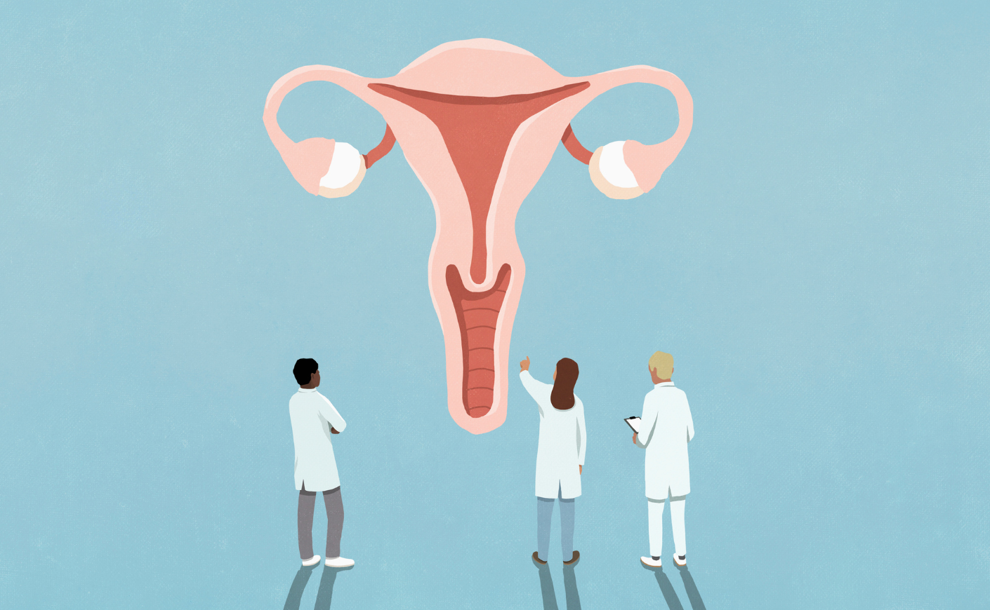 Illustration of doctors examining ovaries