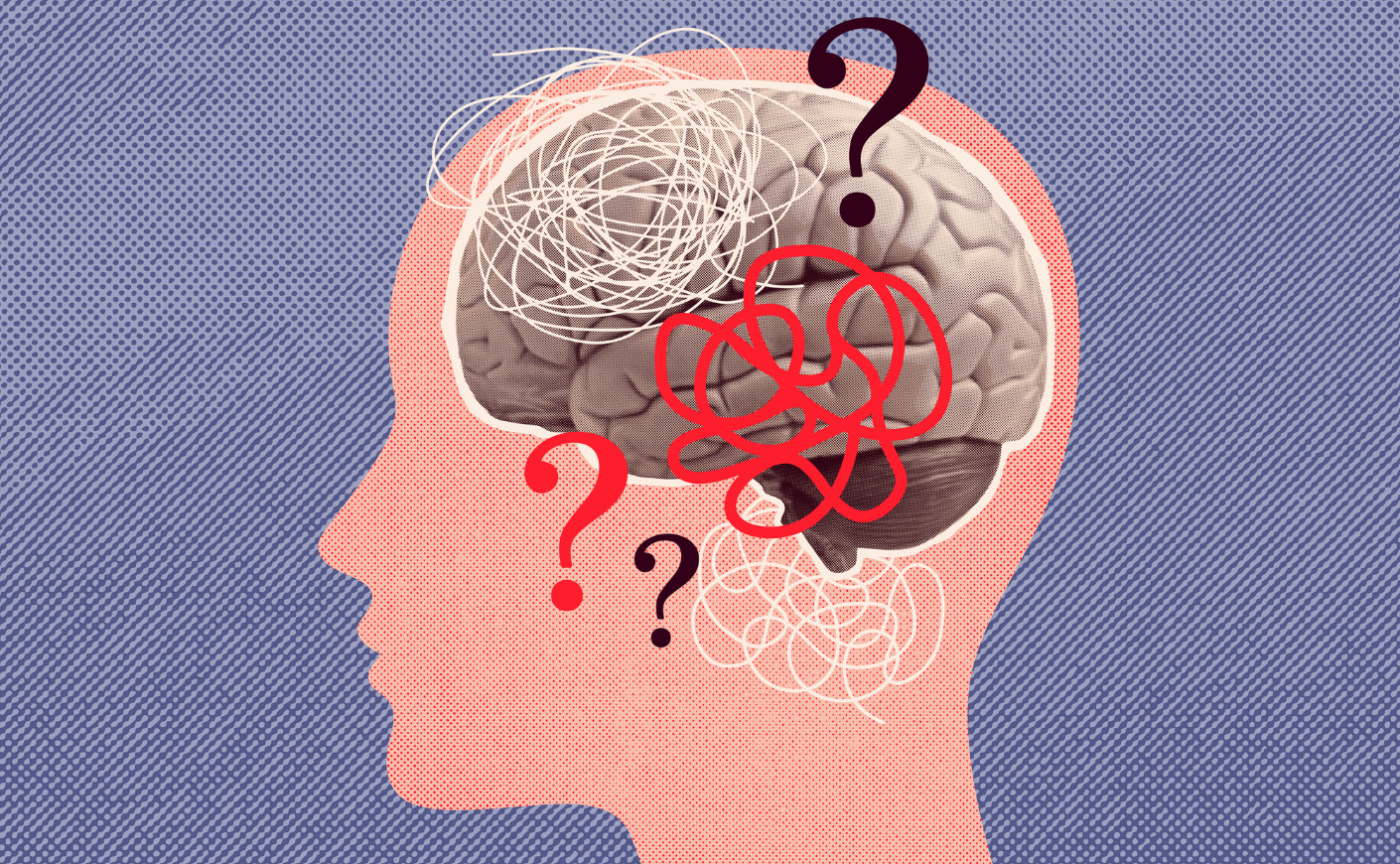illustration of question marks in the brain