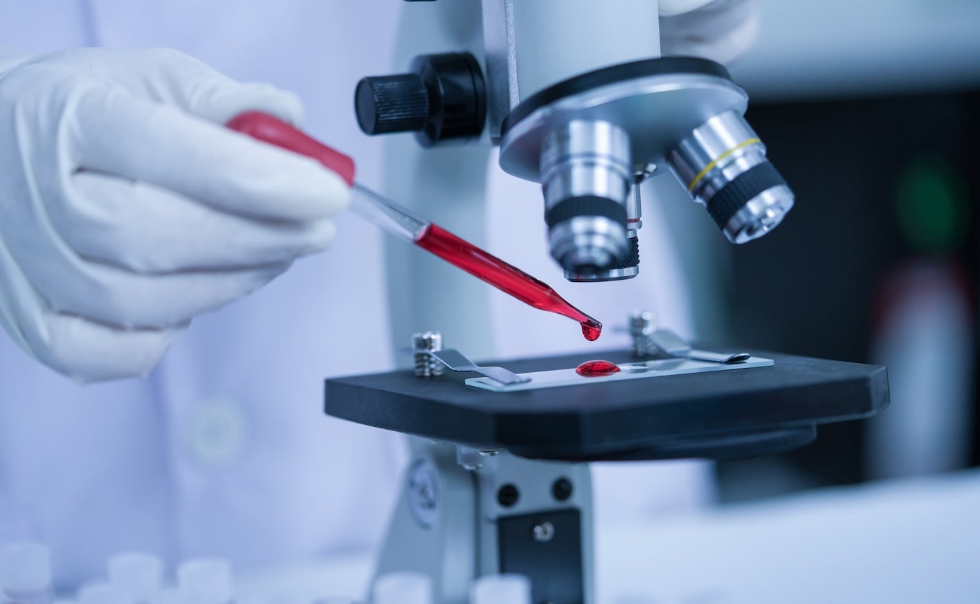 Image of pipette with blood being dripped onto microscope slide