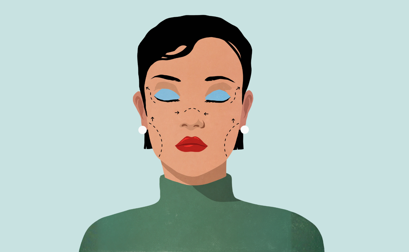 facelift