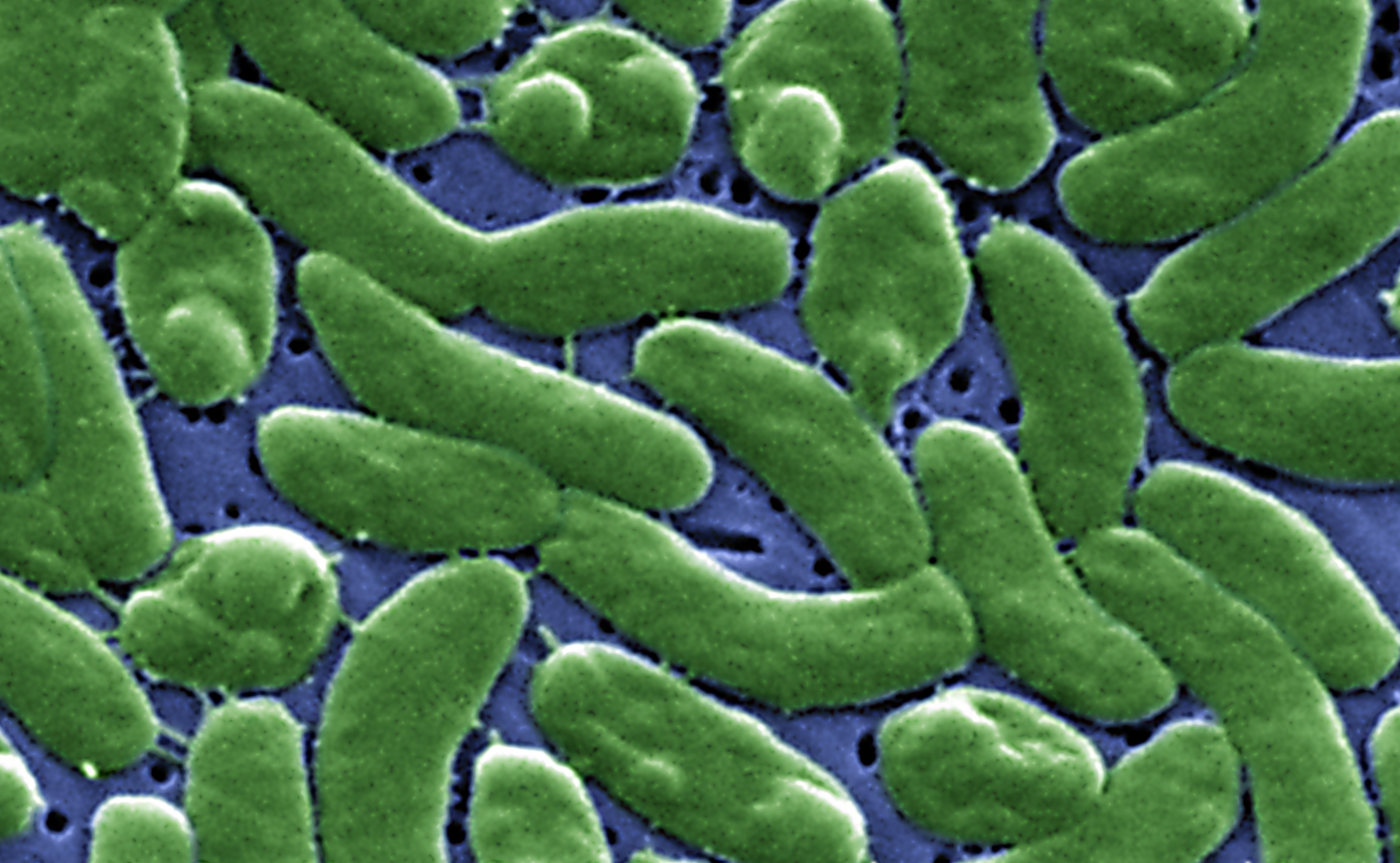 close up of flesh-eating bacteria